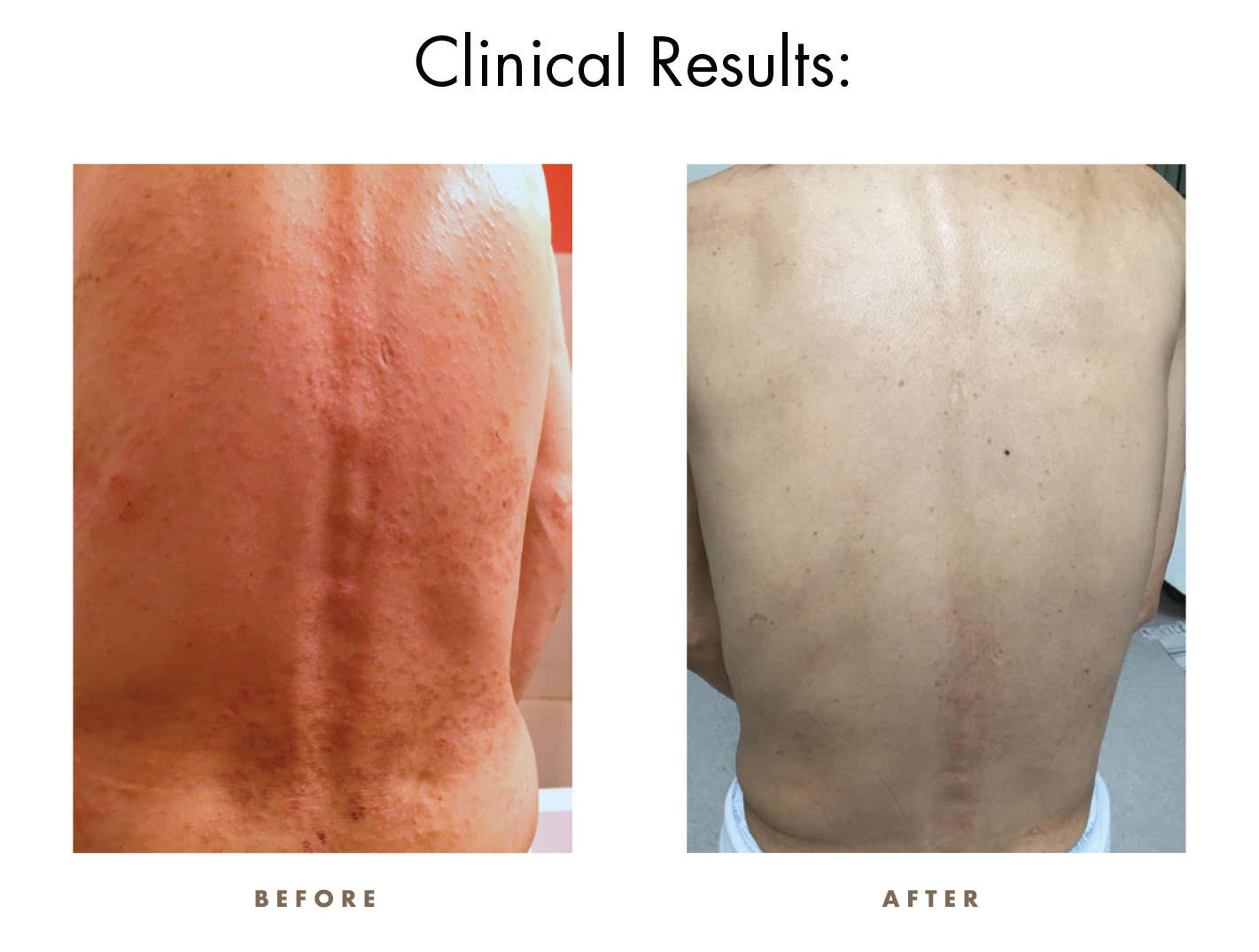 Natural Radiation Cream CamWell Herb to Soothe Burn Relief